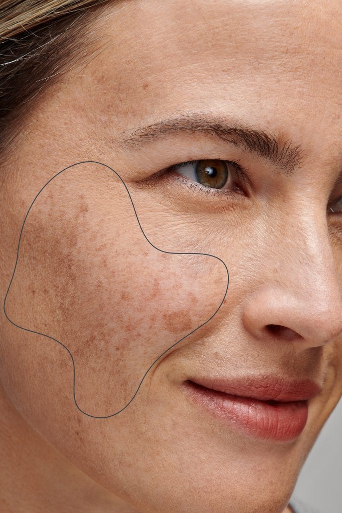 Dermalogica Powerbright dark spot serum