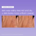 Dermalogica Stabilizing Repair Serum
